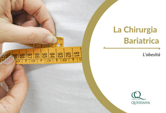 La Chirurgia Bariatrica